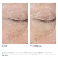 InterFuse Treatment Cream EYE