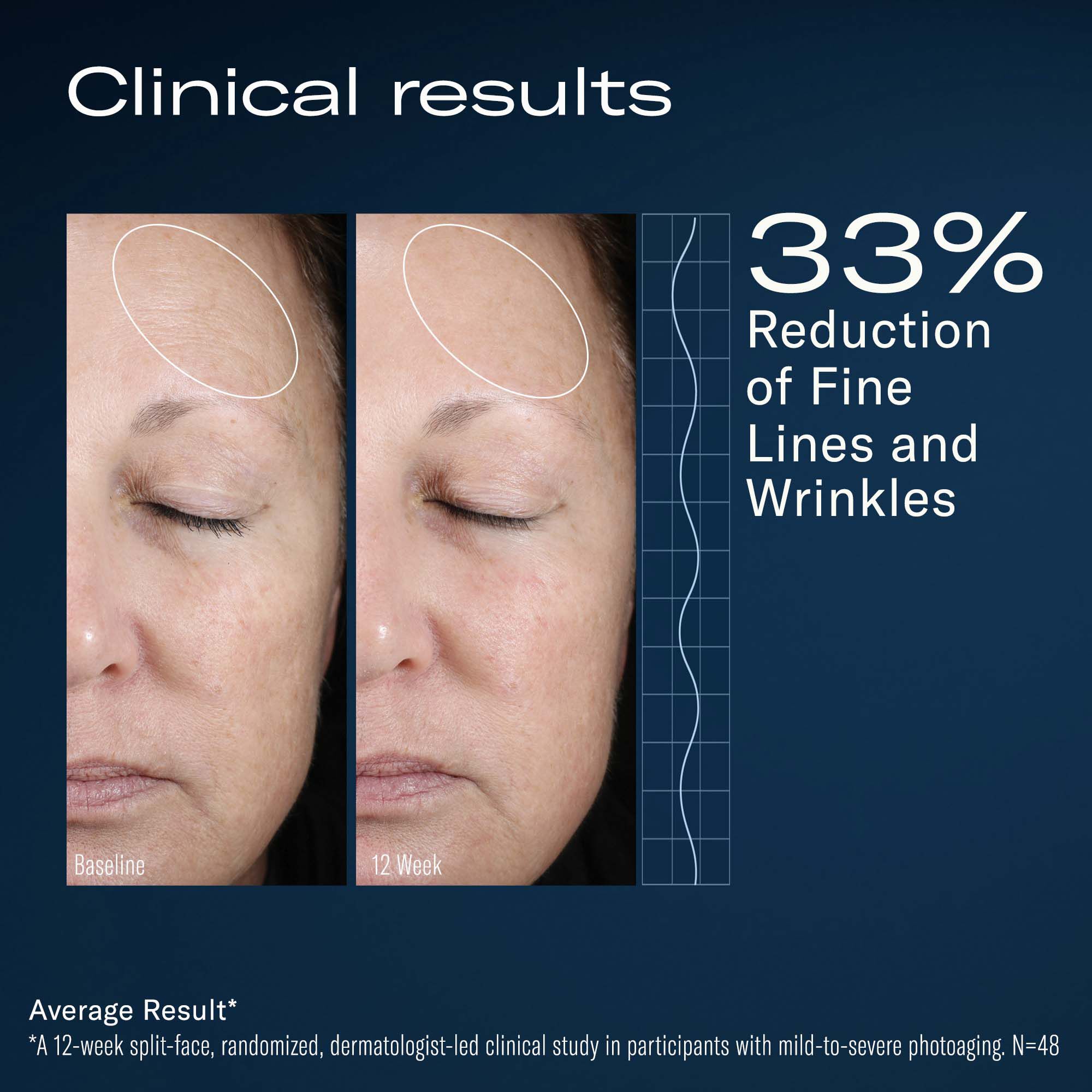 Before and after facial comparisons labeled baseline and 12 weeks, with text stating a 33% reduction of fine lines and wrinkles as an average clinical result.