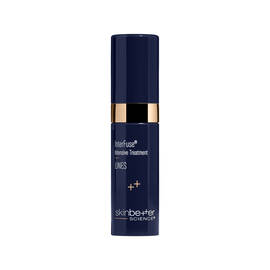InterFuse Intensive Treatment LINES 5 ml