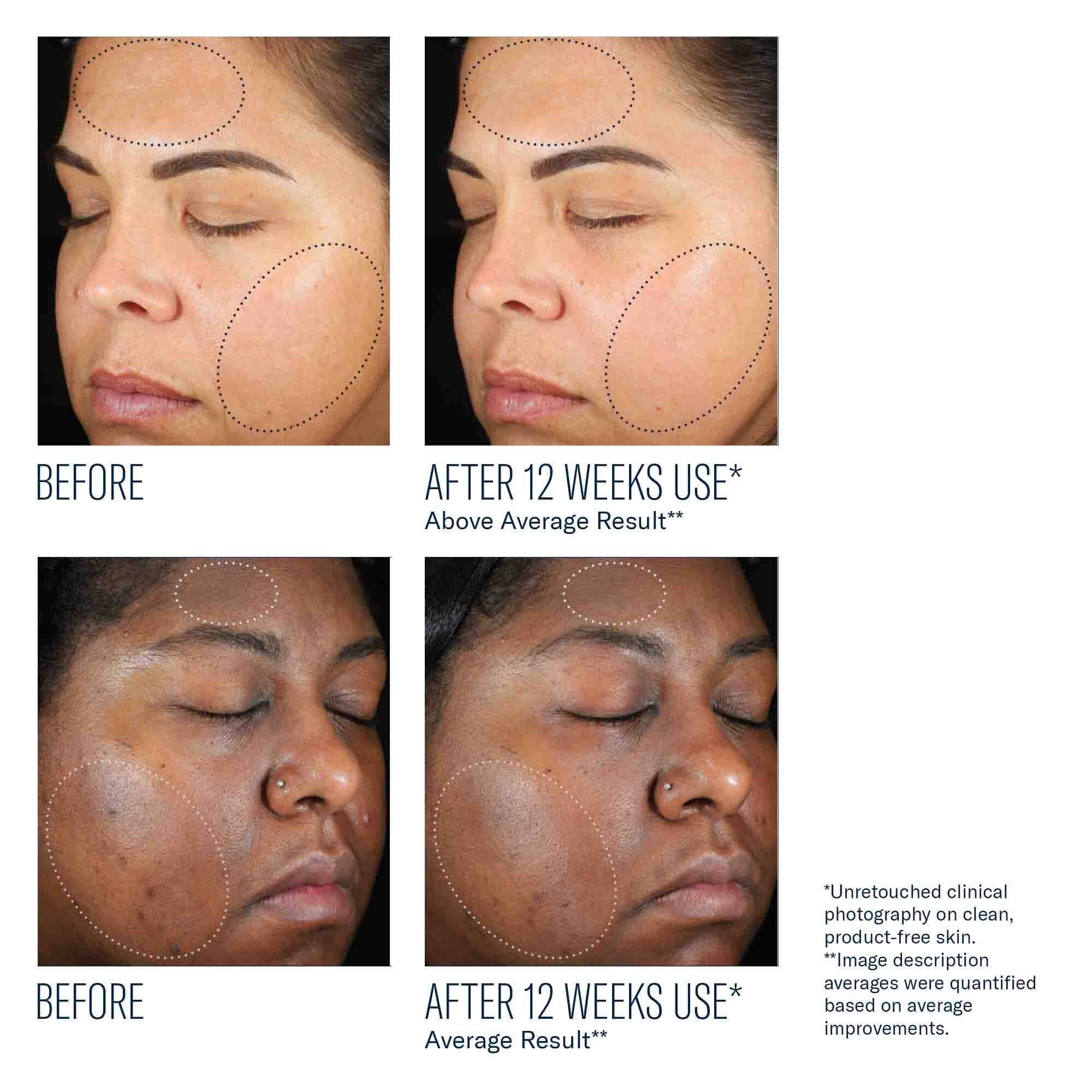 Intensive Glow Regimen