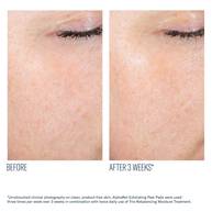 AlphaRet Exfoliating Peel Pads