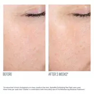 AlphaRet Exfoliating Peel Pads