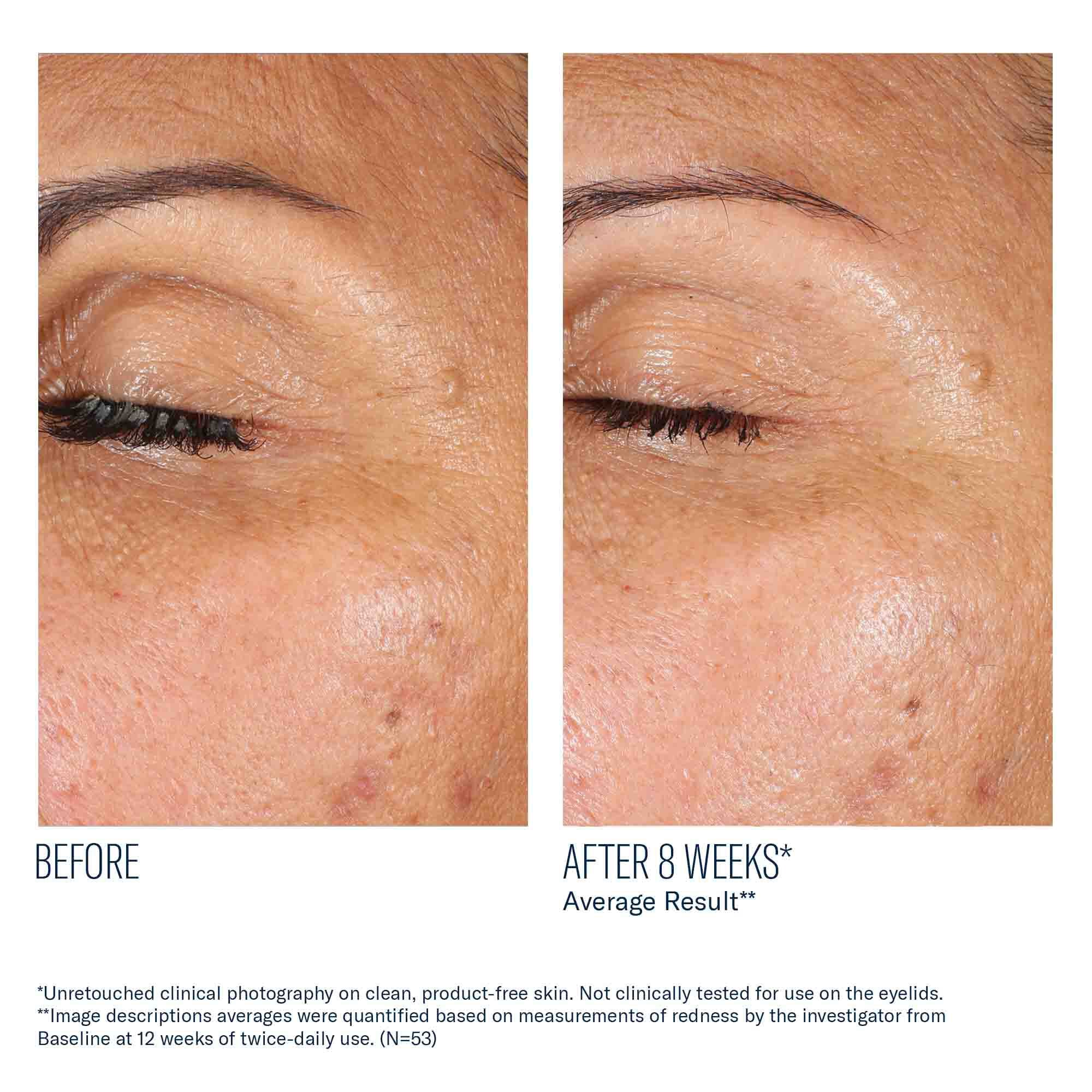 EyeMax AlphaRet Overnight Cream