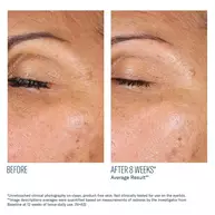 EyeMax AlphaRet Overnight Cream