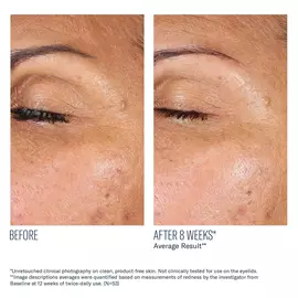 EyeMax AlphaRet Overnight Cream
