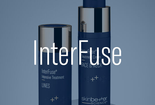 InterFuse